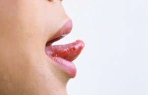 Почему болит язык? Причины возникновения боли